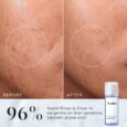 Medik8 Press & Clear (150ml)